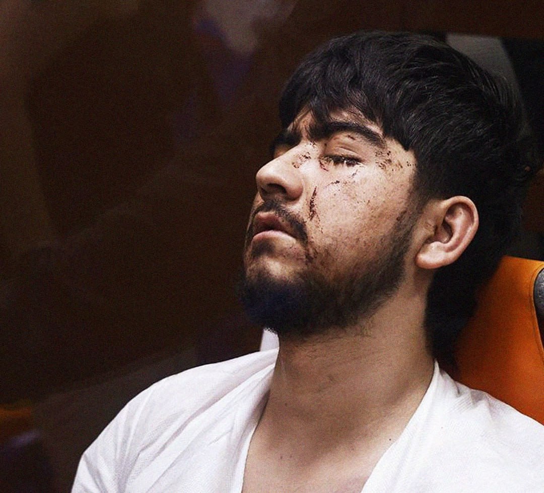 Террорист из «Крокуса» жалуется на ЖЕСТОКОЕ задержание — силовики спилили дерево, на котором он прятался!