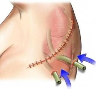 ������������ ��������� �������;