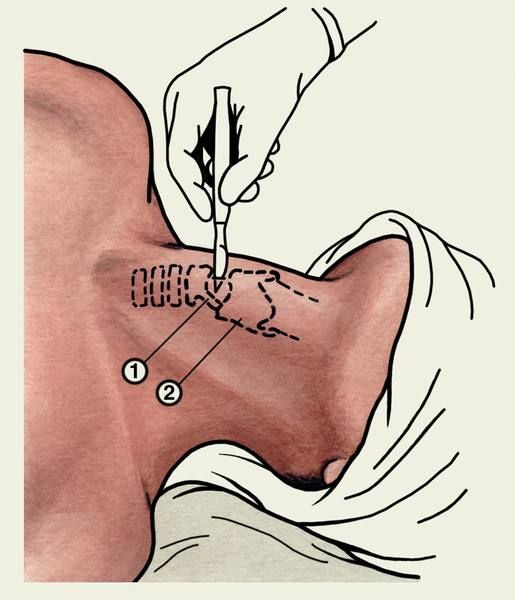 ������������ ��������� �������;