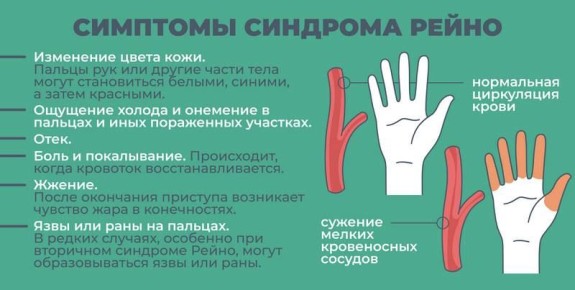 ������ �������: ������������ ��������� �������;